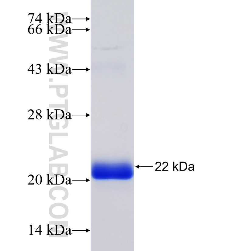 RAD50 fusion protein Ag34589 SDS-PAGE