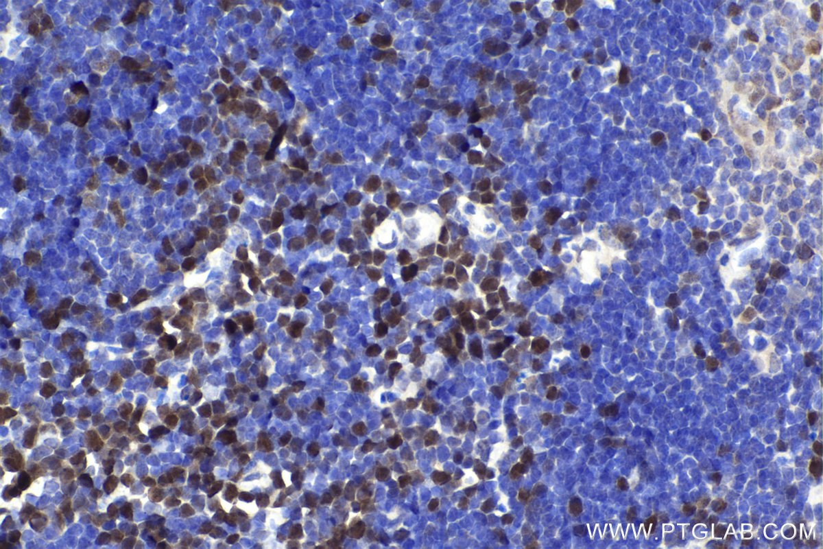 IHC staining of mouse thymus using 14961-1-AP
