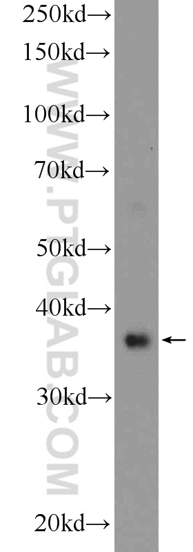RAD51 Polyclonal antibody