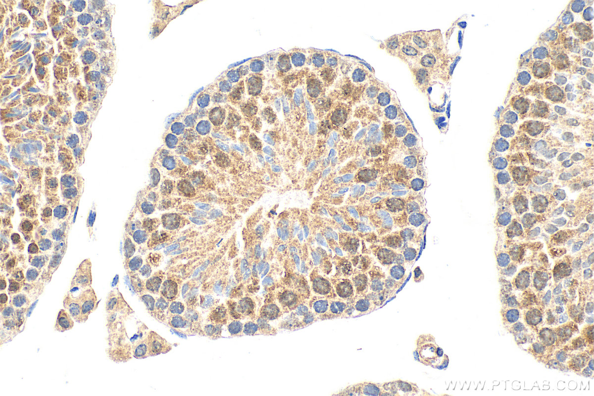 IHC staining of mouse testis using 31678-1-AP