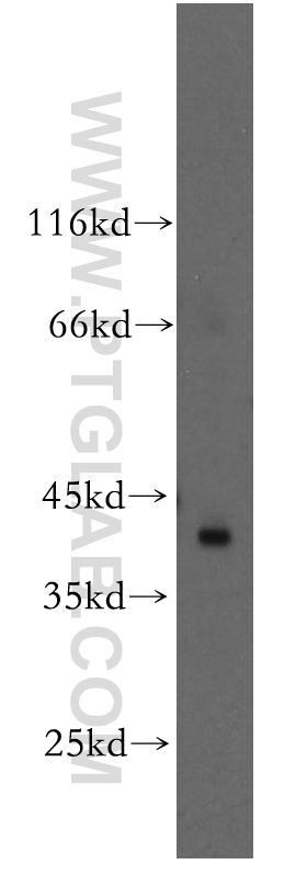 WB analysis of HeLa using 13555-1-AP