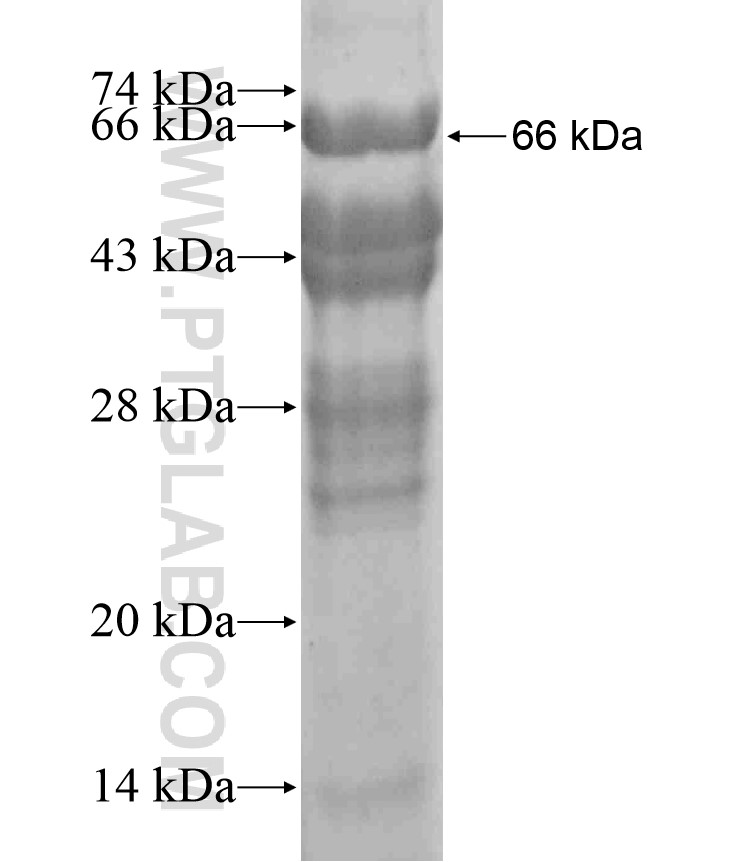 RAD54L2 fusion protein Ag17995 SDS-PAGE RAD54L2 fusion protein Ag17995 SDS-PAGE
