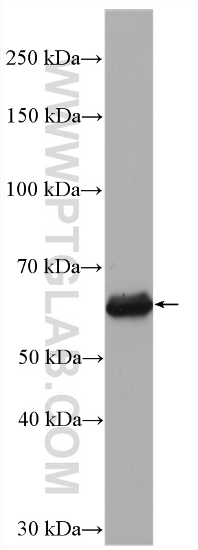 WB analysis of HeLa using 13035-1-AP