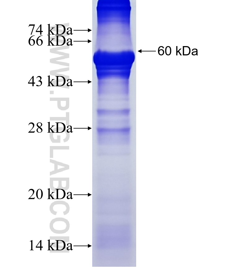 RAD9B fusion protein Ag14009 SDS-PAGE