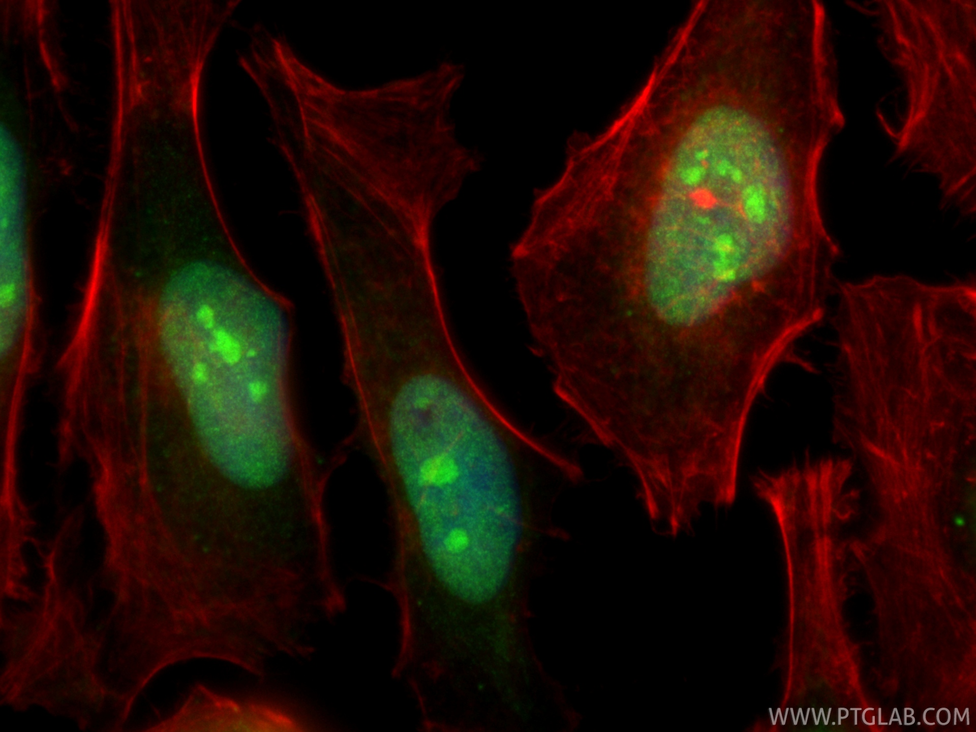 IF Staining of HeLa using 20284-1-AP IF Staining of HeLa using 20284-1-AP