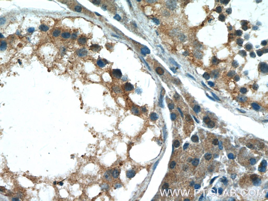 IHC staining of human testis using 20491-1-AP