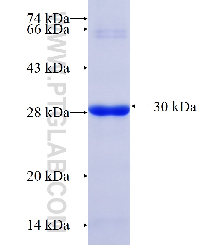 RAET1E fusion protein Ag35254 SDS-PAGE RAET1E fusion protein Ag35254 SDS-PAGE