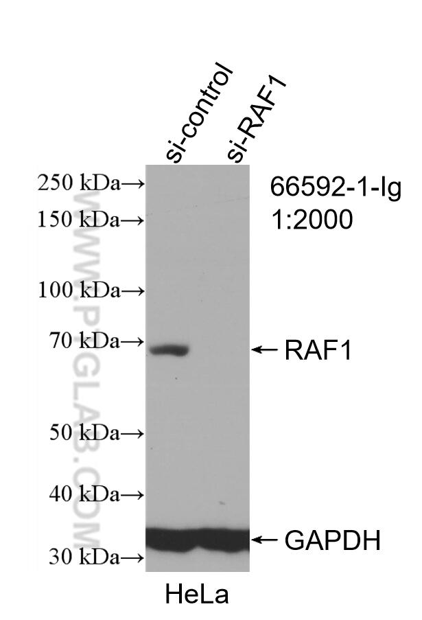 WB analysis of HEK-293 using 66592-1-Ig