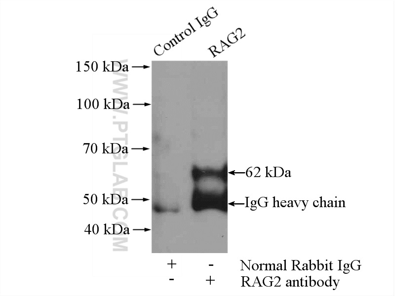 IP experiment of A375 using 11825-1-AP