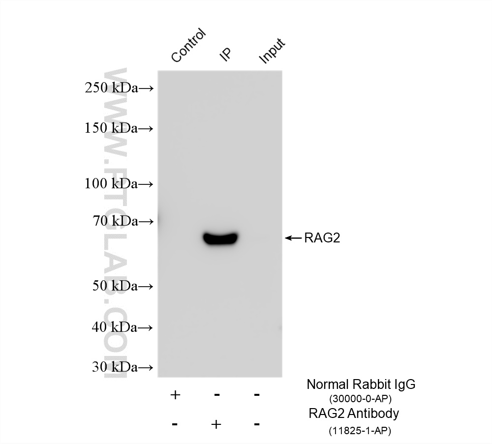 IP experiment of mouse thymus using 11825-1-AP (same clone as 11825-1-PBS) IP experiment of mouse thymus using 11825-1-AP (same clone as 11825-1-PBS)