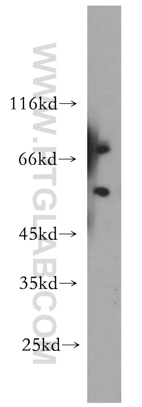 WB analysis of A375 using 11825-1-AP