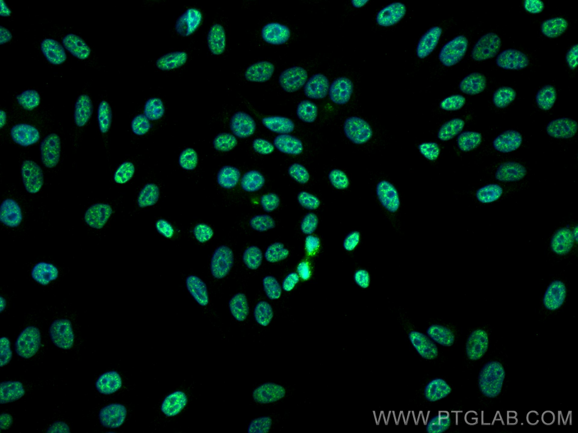IF Staining of HepG2 using 66998-1-Ig (same clone as 66998-1-PBS)