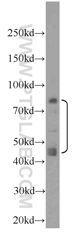 WB analysis of HeLa using 23926-1-AP