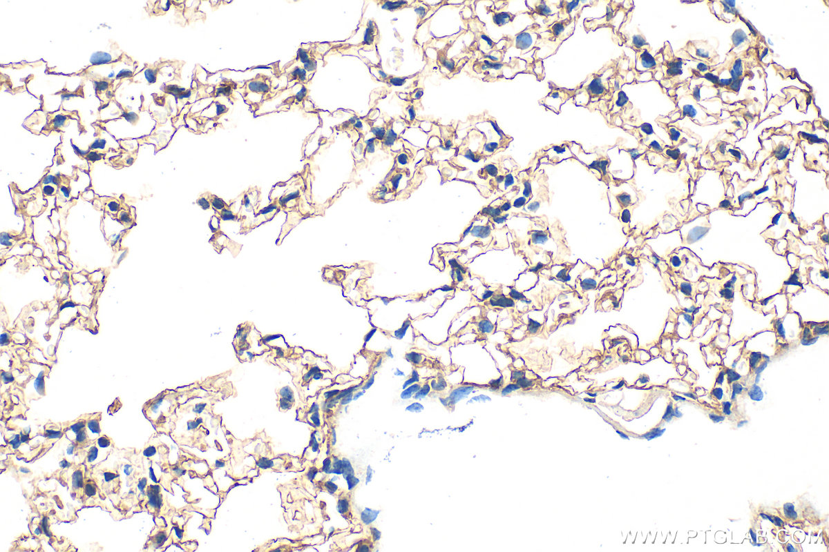 IHC staining of mouse lung using 31122-1-AP