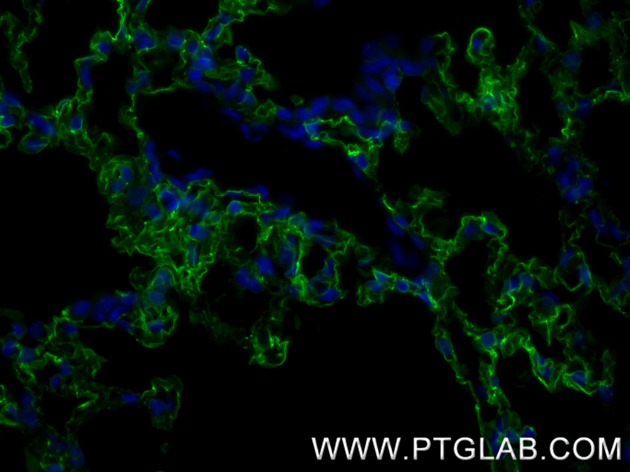 IF Staining of mouse lung using 83742-5-RR
