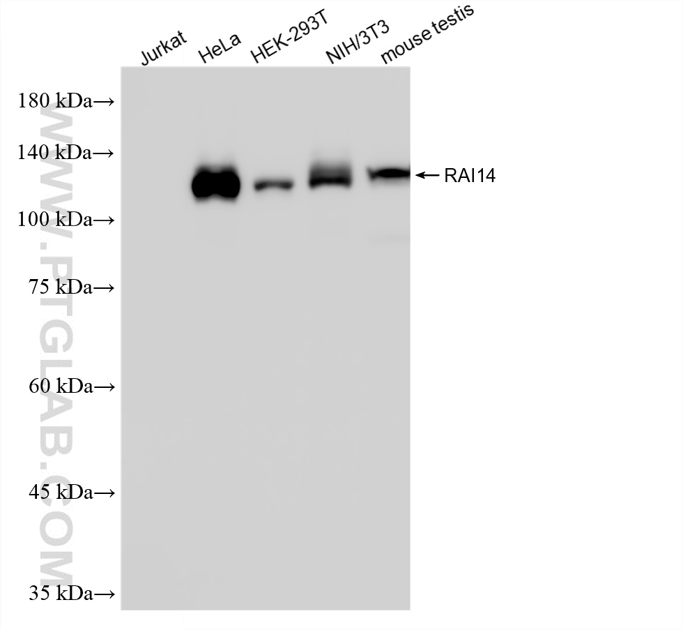 WB analysis using 86581-1-RR (same clone as 86581-1-PBS)