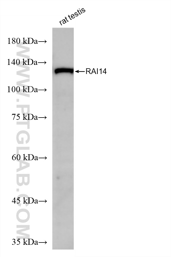WB analysis of rat testis using 86581-1-RR (same clone as 86581-1-PBS)