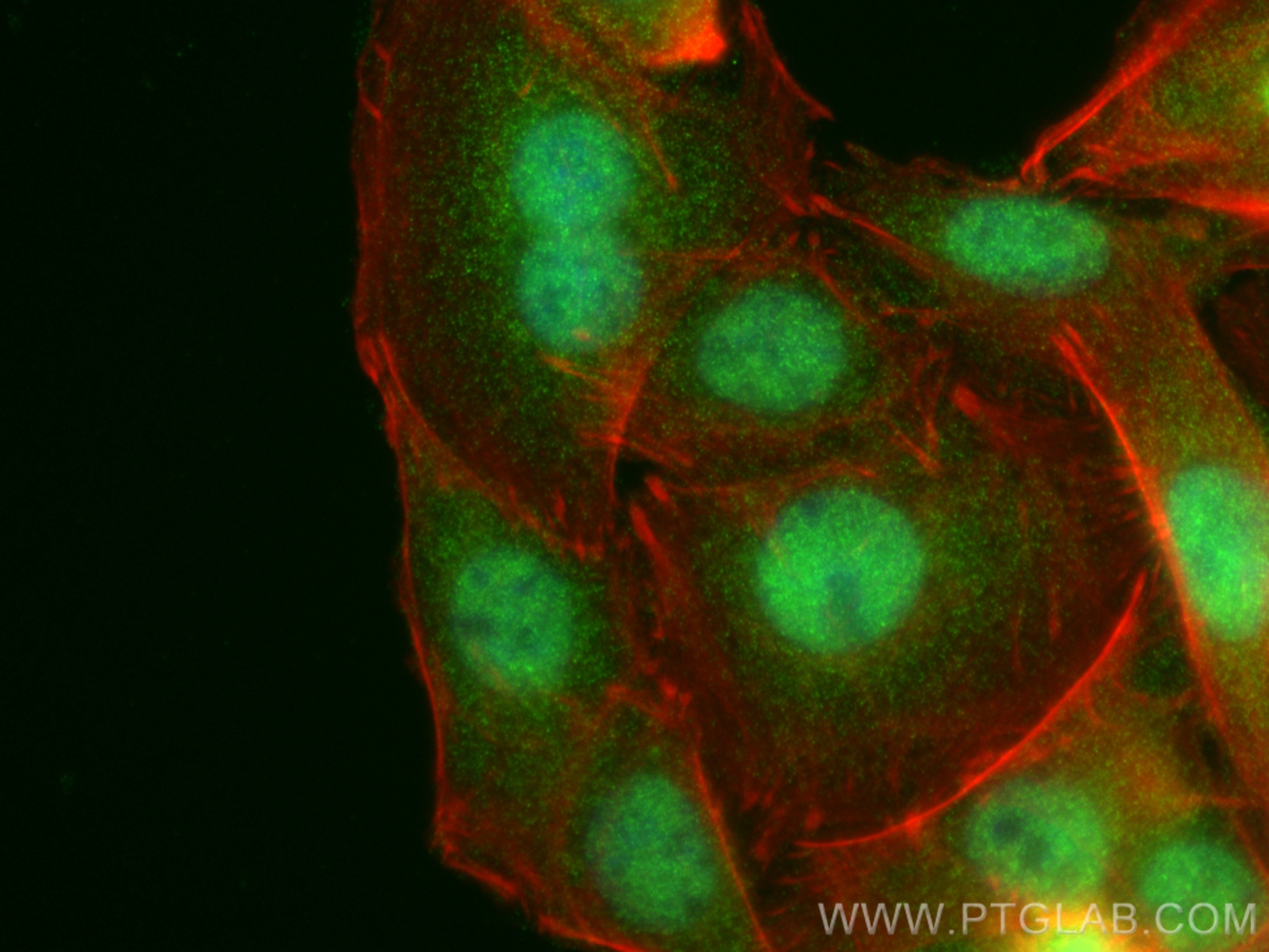 IF Staining of SW480 using 28217-1-AP