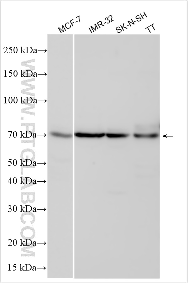 WB analysis using 28217-1-AP
