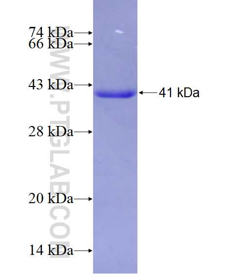 RAI2 fusion protein Ag28240 SDS-PAGE RAI2 fusion protein Ag28240 SDS-PAGE
