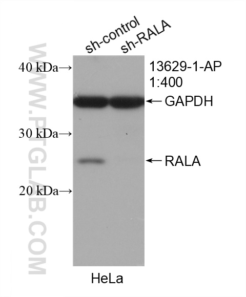 WB analysis of HeLa using 13629-1-AP