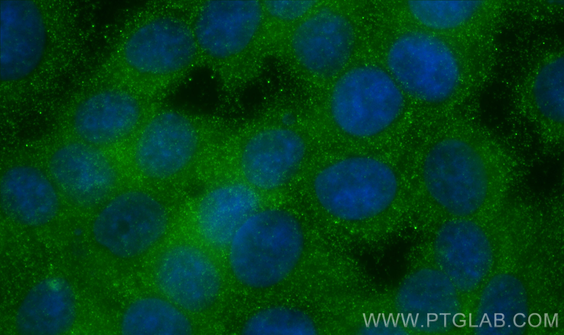 IF Staining of MCF-7 using 67093-1-Ig