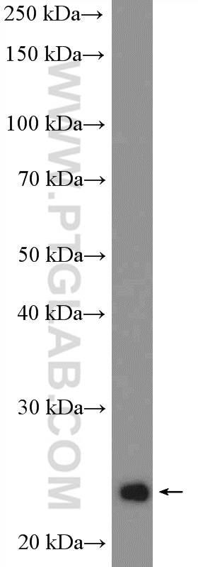 WB analysis of Y79 using 12340-1-AP