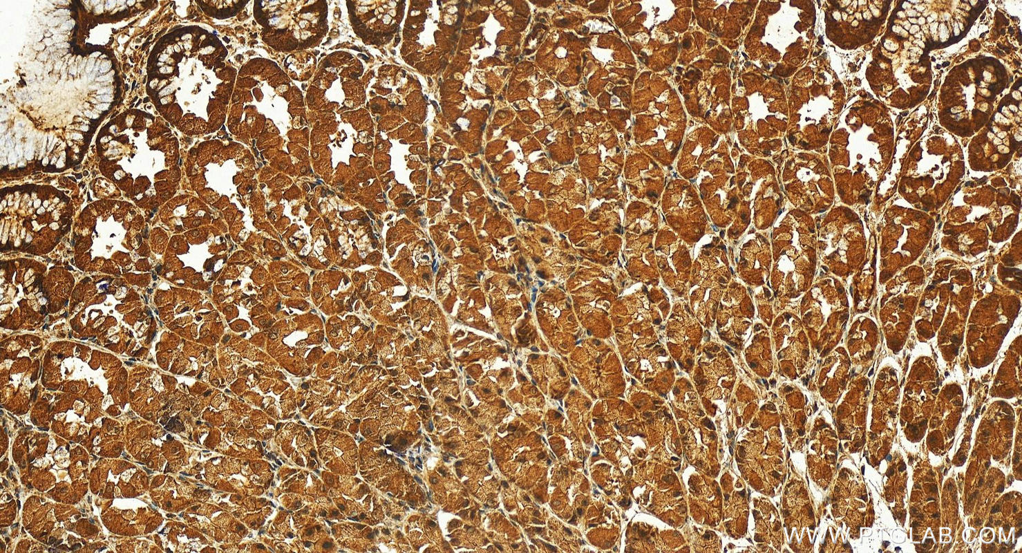 IHC staining of human stomach using 13176-1-AP