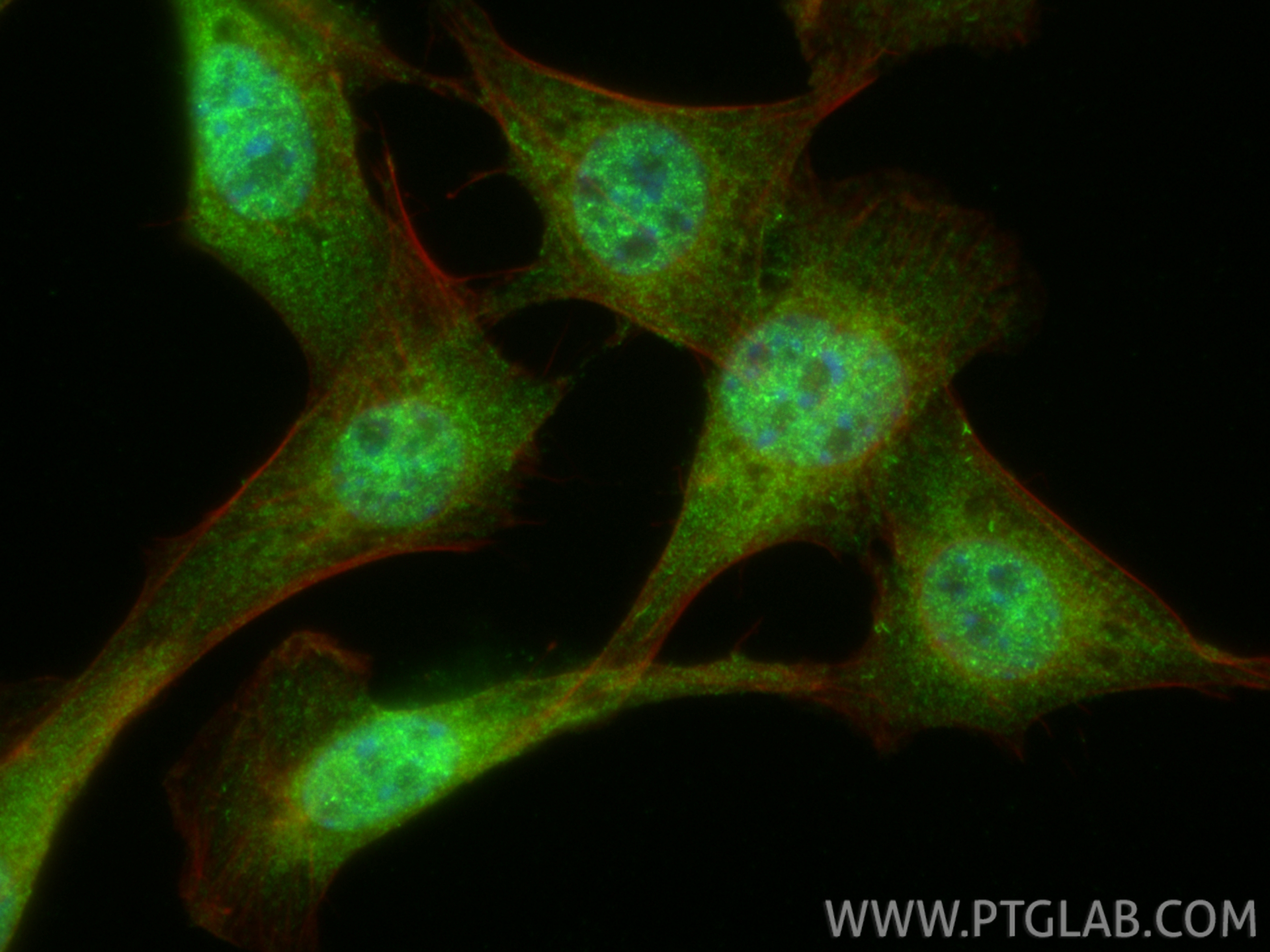 IF Staining of NIH/3T3 using 13176-1-AP IF Staining of NIH/3T3 using 13176-1-AP
