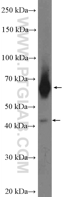 WB analysis of mouse kidney using 13368-1-AP