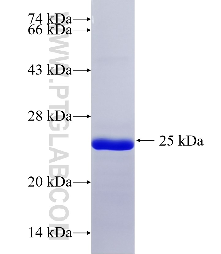 RALGPS2 fusion protein Ag35024 SDS-PAGE RALGPS2 fusion protein Ag35024 SDS-PAGE