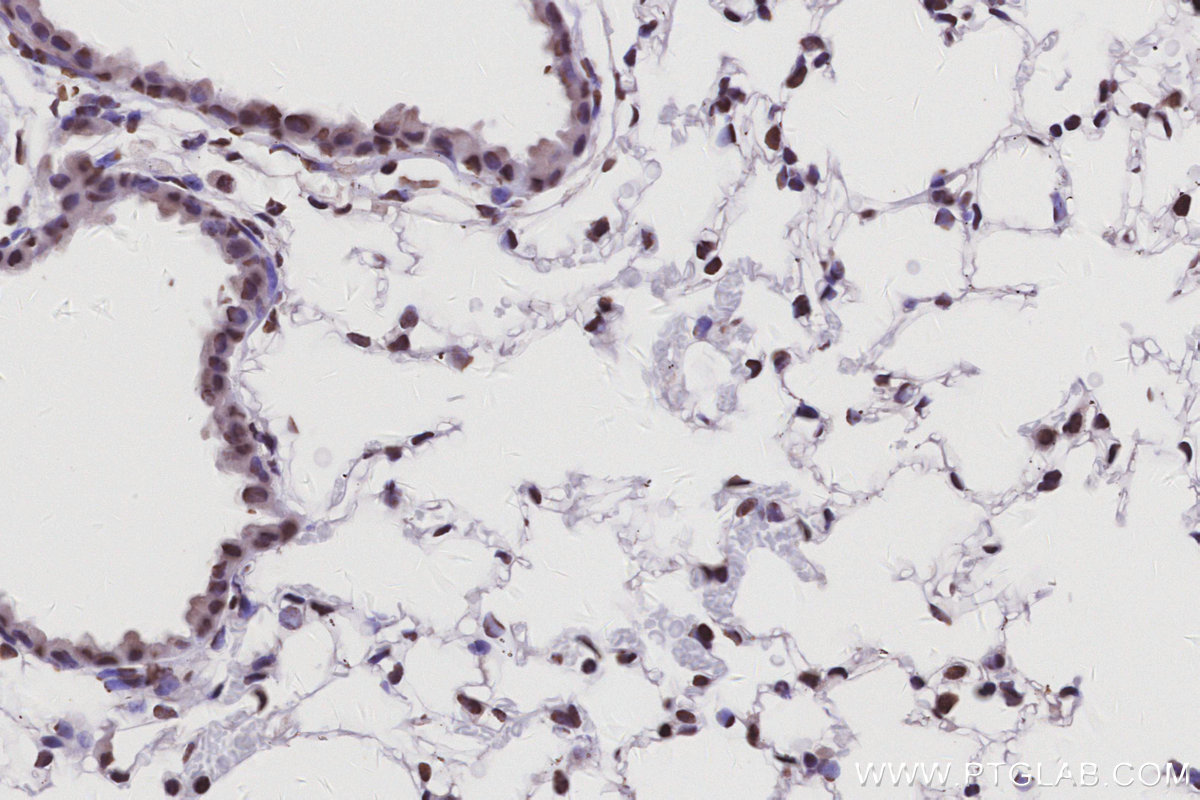 IHC staining of mouse lung using 17896-1-AP