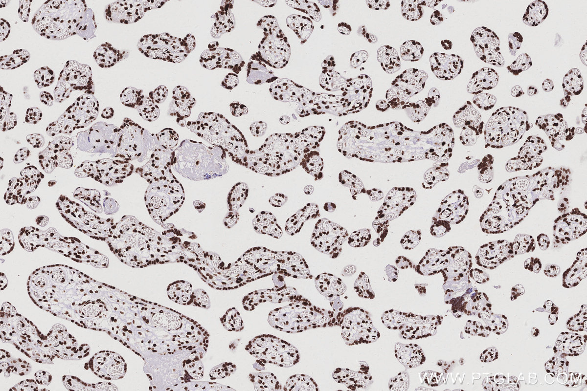 IHC staining of human placenta using 17896-1-AP