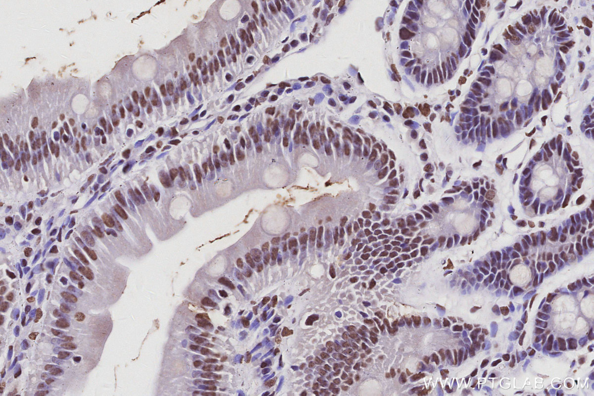 IHC staining of rat small intestine using 17896-1-AP