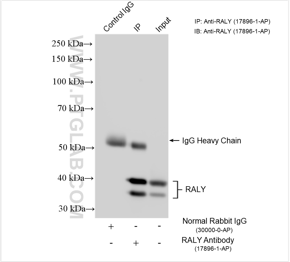 IP experiment of HEK-293T using 17896-1-AP