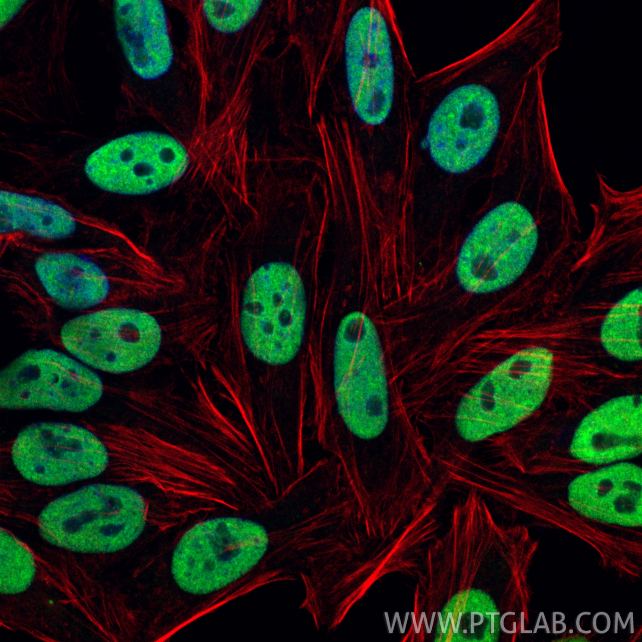 IF Staining of HepG2 using 67534-1-Ig IF Staining of HepG2 using 67534-1-Ig