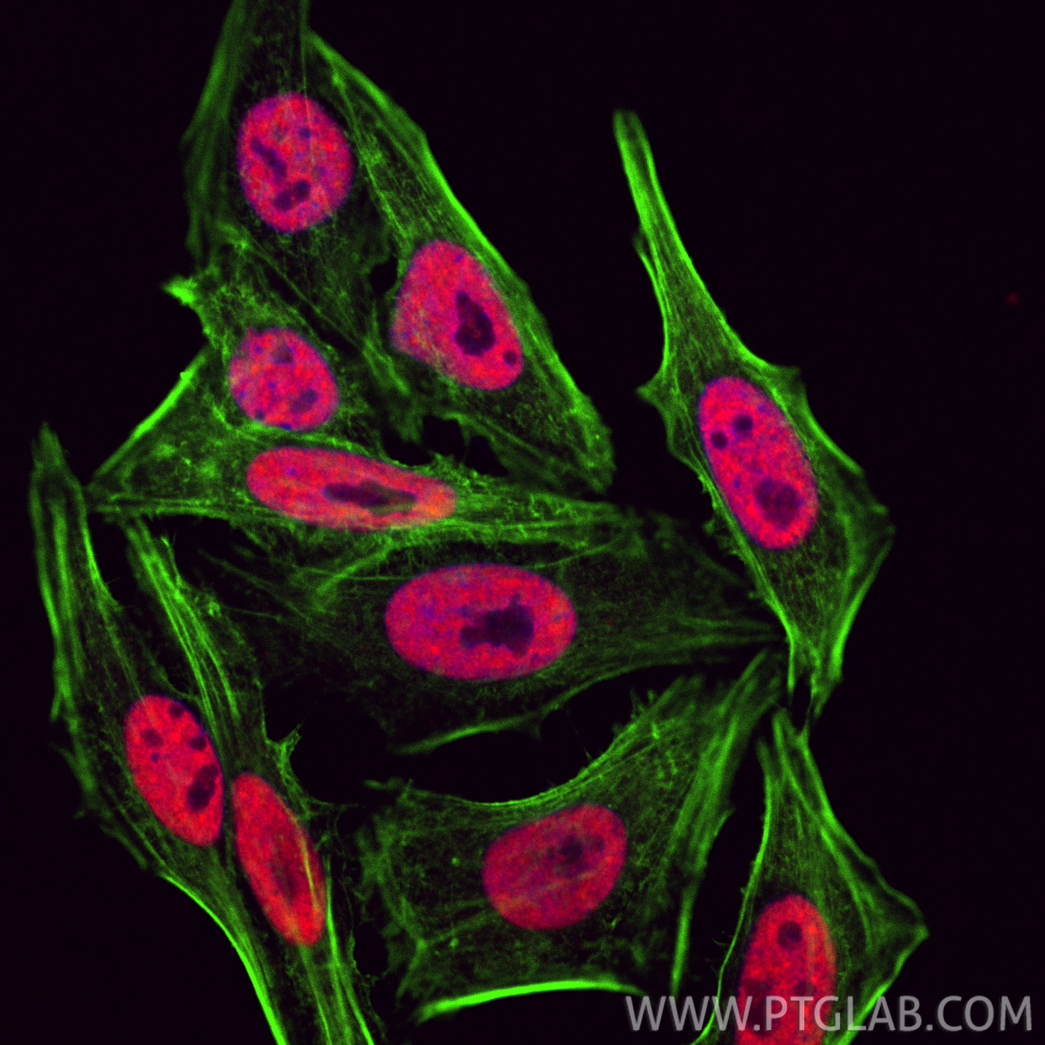 IF Staining of HepG2 using CL594-67534 IF Staining of HepG2 using CL594-67534