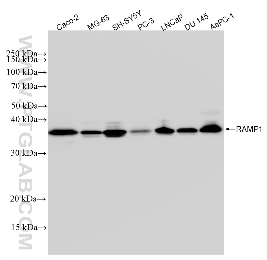 WB analysis using 85271-2-RR WB analysis using 85271-2-RR