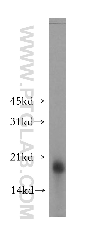 WB analysis of mouse brain using 13223-2-AP