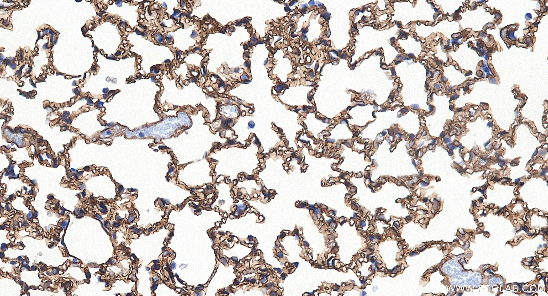 IHC staining of mouse lung using 88020-3-RR (same clone as 88020-3-PBS) IHC staining of mouse lung using 88020-3-RR (same clone as 88020-3-PBS)