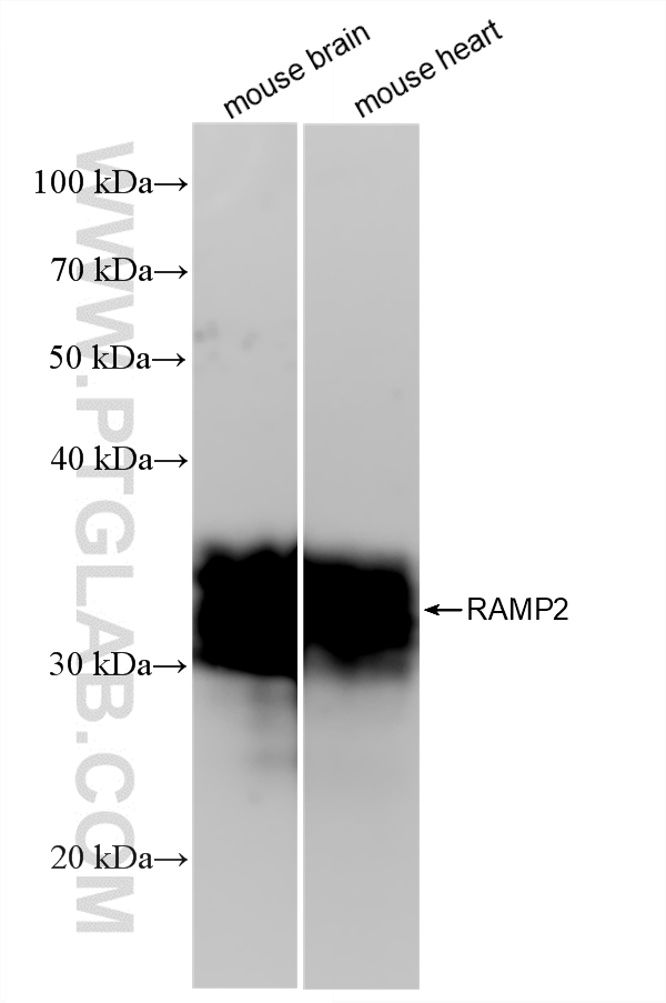 WB analysis using 88020-3-RR (same clone as 88020-3-PBS) WB analysis using 88020-3-RR (same clone as 88020-3-PBS)