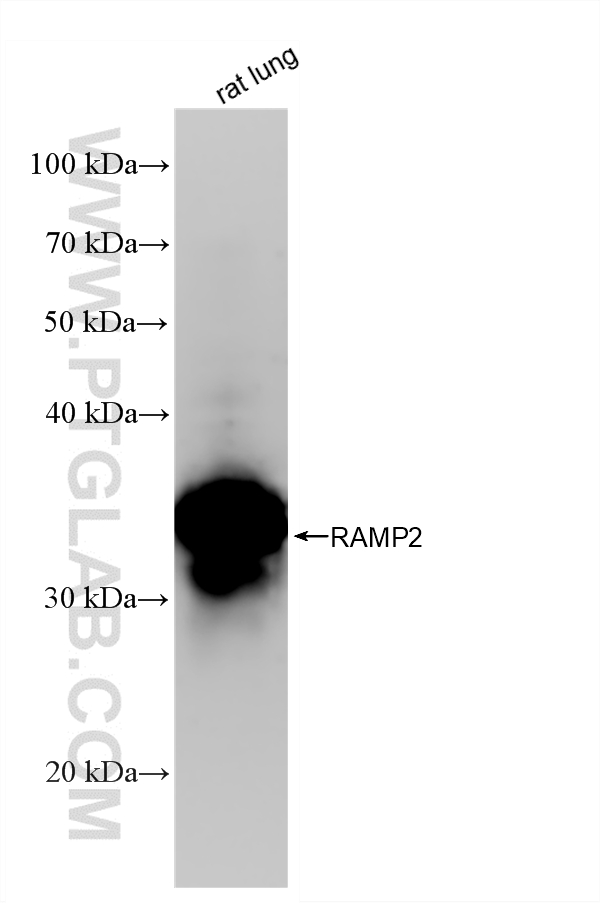 WB analysis of rat lung using 88020-3-RR (same clone as 88020-3-PBS) WB analysis of rat lung using 88020-3-RR (same clone as 88020-3-PBS)
