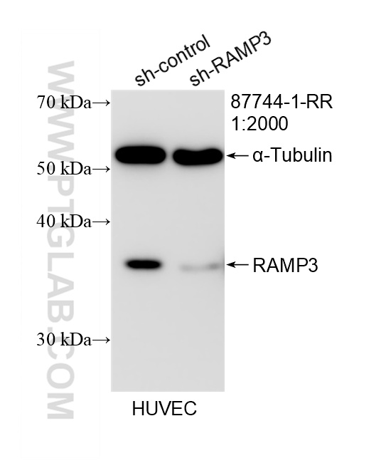 WB analysis of HUVEC using 87744-1-RR (same clone as 87744-1-PBS)