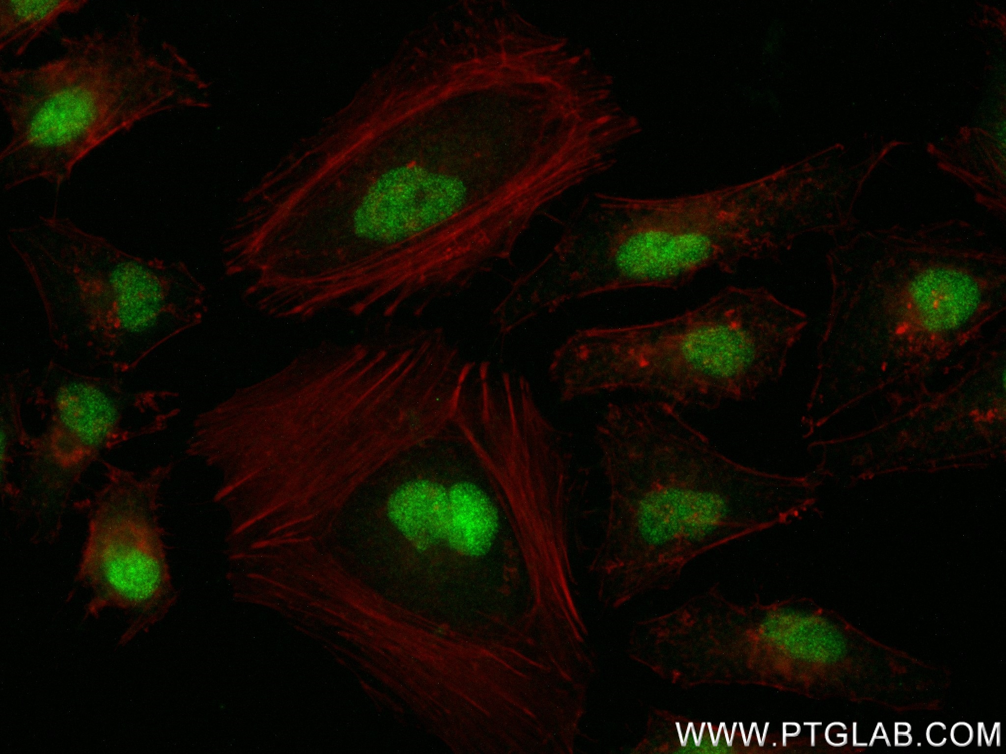 IF Staining of HeLa using 82978-1-RR (same clone as 82978-1-PBS)