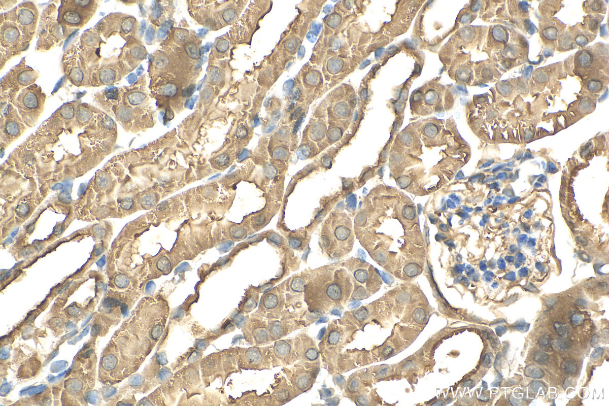 IHC staining of mouse kidney using 82978-1-RR (same clone as 82978-1-PBS)