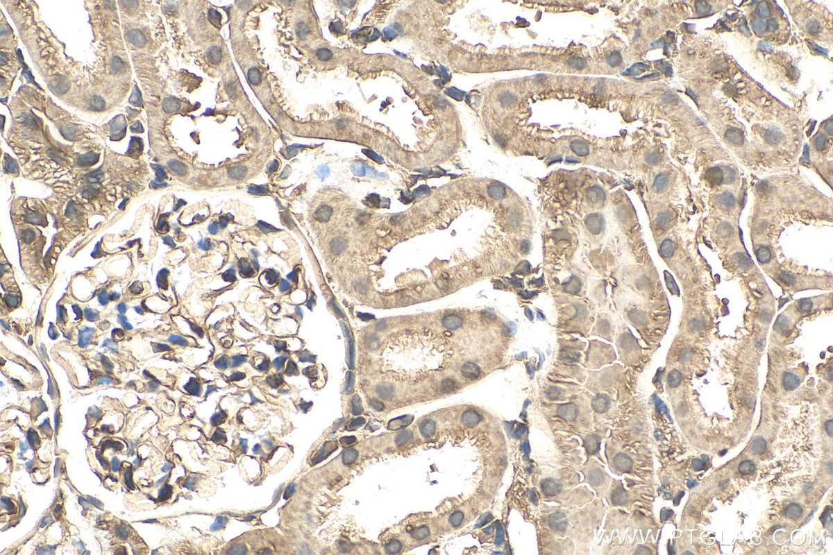 IHC staining of rat kidney using 82978-1-RR (same clone as 82978-1-PBS)
