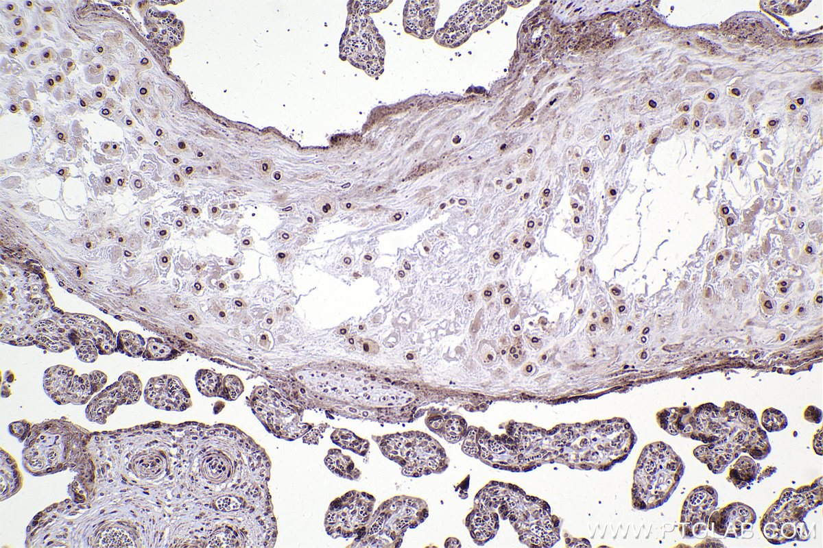 IHC staining of human placenta using 82978-1-RR (same clone as 82978-1-PBS)