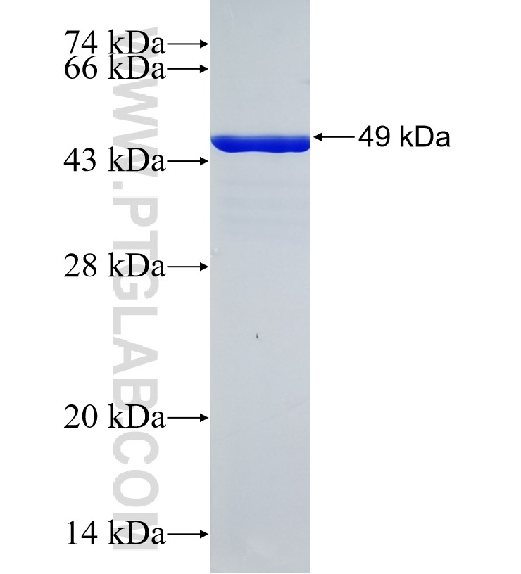 RANBP3 fusion protein Ag26000 SDS-PAGE