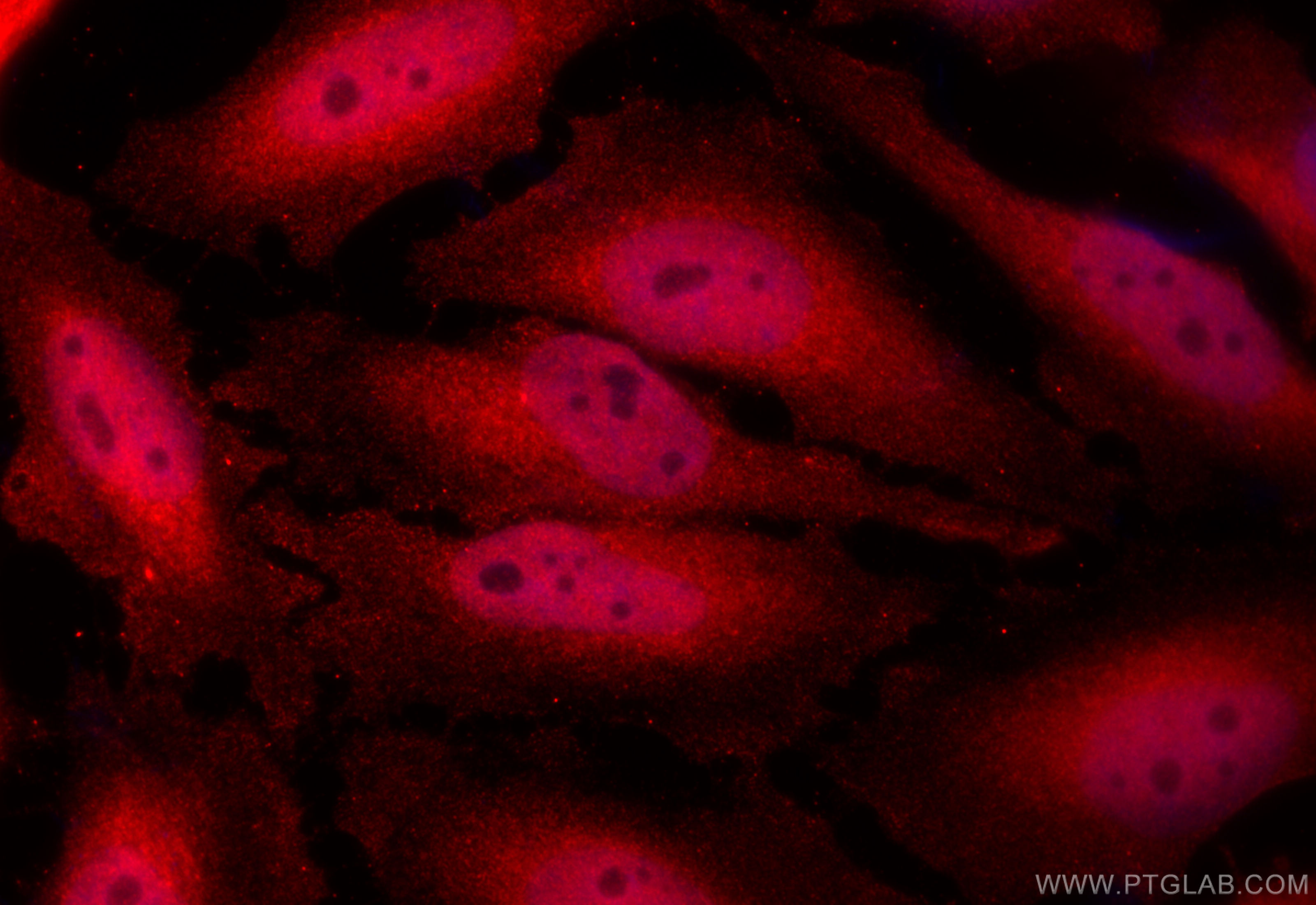 IF Staining of HeLa using 17755-1-AP