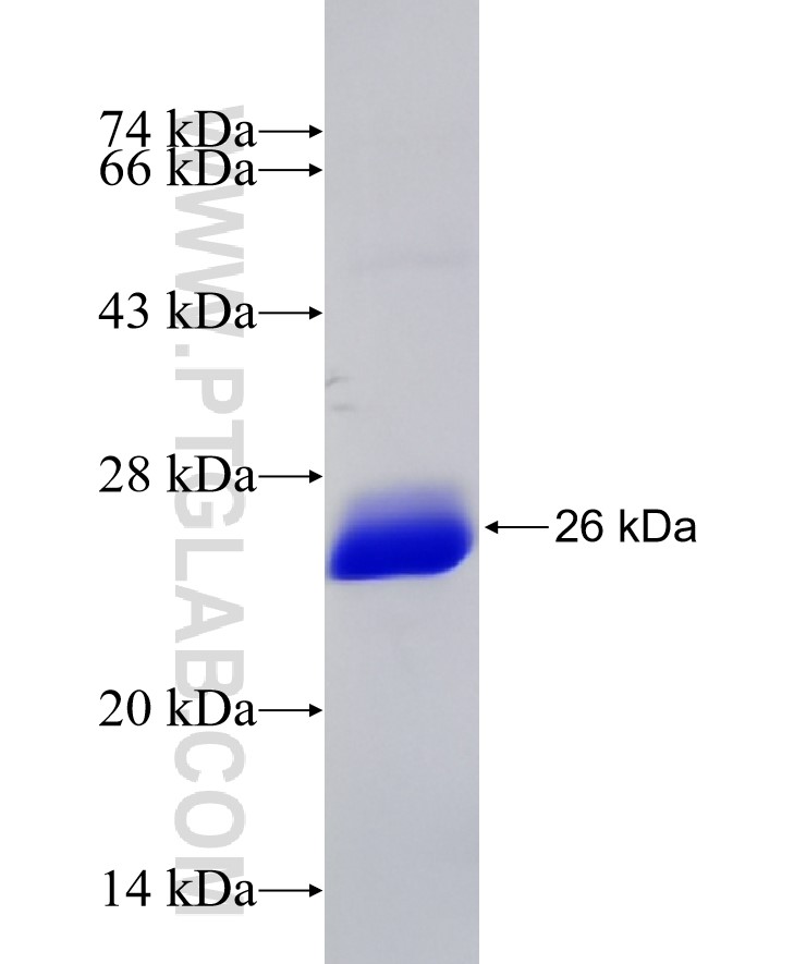 RANBP9 fusion protein Ag32327 SDS-PAGE RANBP9 fusion protein Ag32327 SDS-PAGE